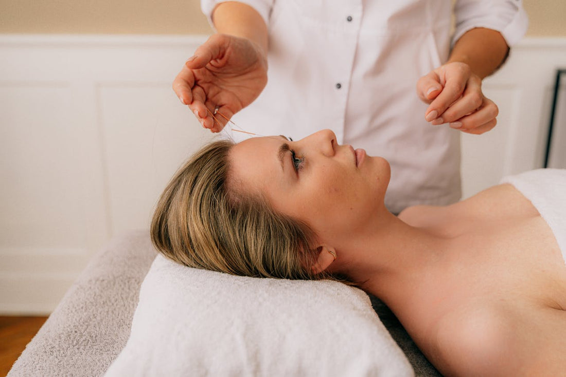 Where Do Acupuncture Needles Go for Fertility