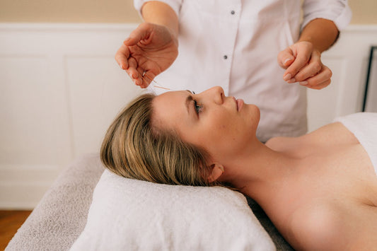 Where Do Acupuncture Needles Go for Fertility